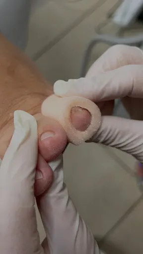 Podologia Elżbieta Trzeciak | Elarto Gabinet Podologiczny Częstochowa